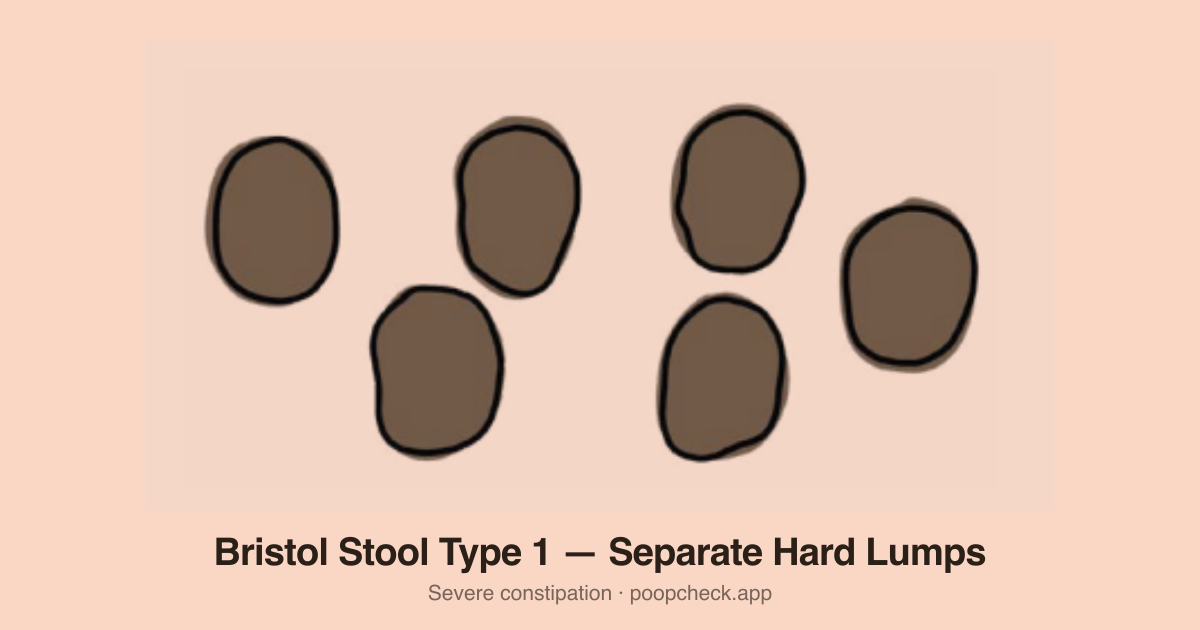 Bristol Stool Chart Type 1: Small, hard, separate lumps that look like nuts or rabbit droppings.