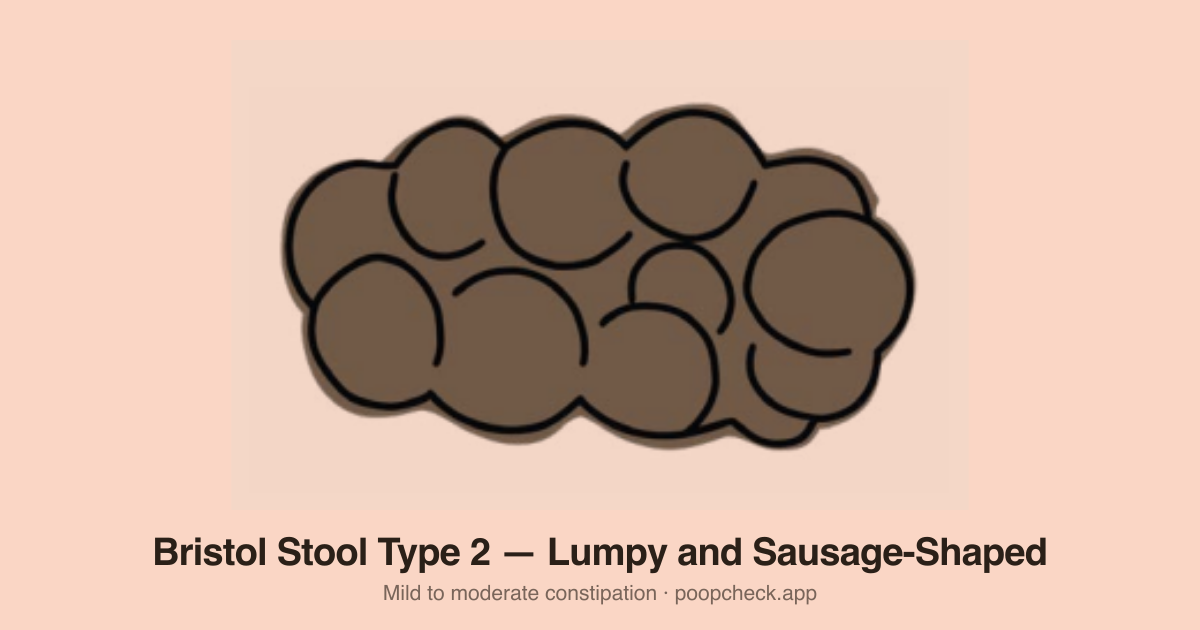 Bristol Stool Chart Type 2: Sausage-shaped but lumpy on the surface — like several Type 1 lumps pressed together.