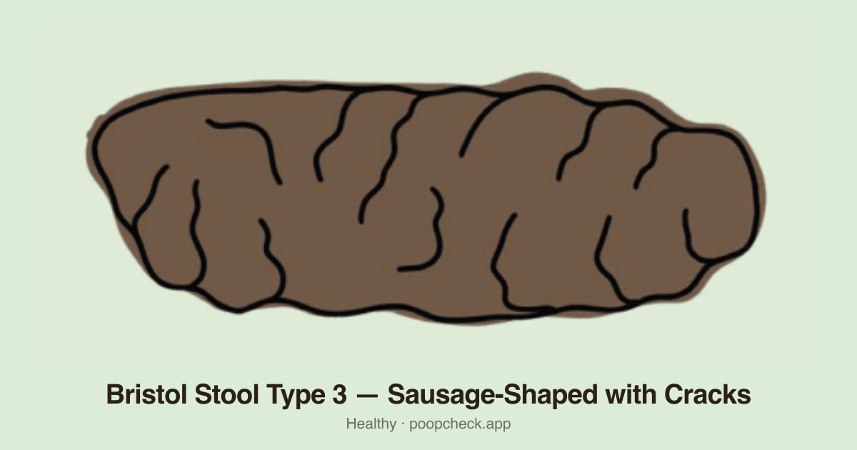 Bristol Stool Chart Type 3: Like a sausage but with cracks on the surface. Holds together, passes smoothly.