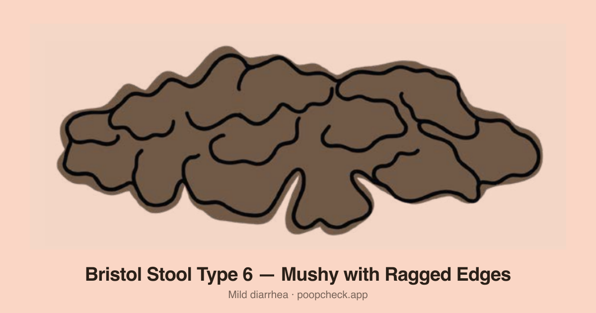 Bristol Stool Chart Type 6: Fluffy pieces with ragged edges, a mushy stool. No definite shape.