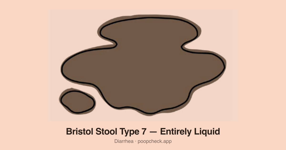 Bristol Stool Chart Type 7: Completely liquid with no solid pieces. Watery.